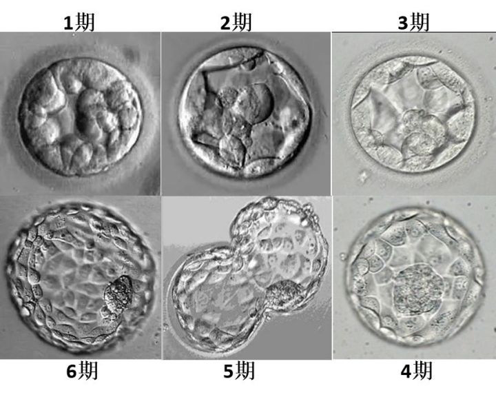 张家口大学第一附属医院的供卵试管婴儿费用