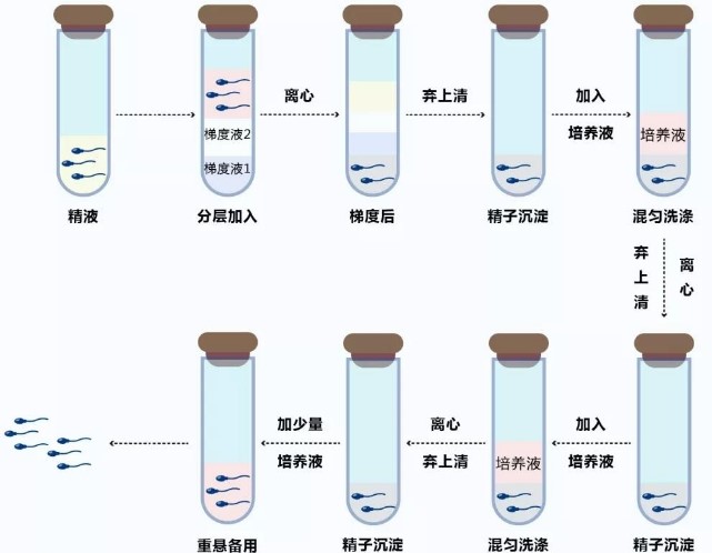 谷氨酰转肽酶高能做供卵试管婴儿吗要看什么？