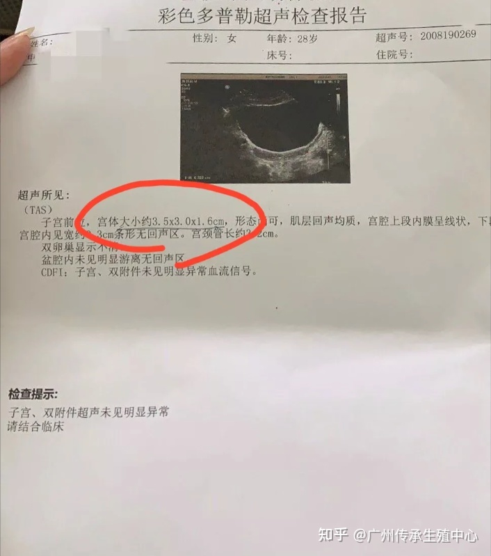 成都试管助孕套餐可靠吗？成都一号借卵助孕自怀机构怎么样？