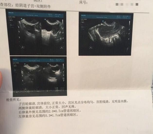 上海第三代借卵助孕供卵试管的费用是多少？