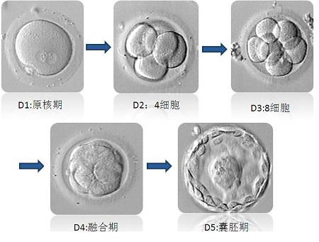 子宫腺肌症供卵试管移植前需要怎样处理