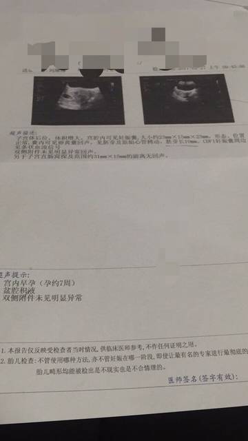 中南医院供卵做试管婴儿费用是多少