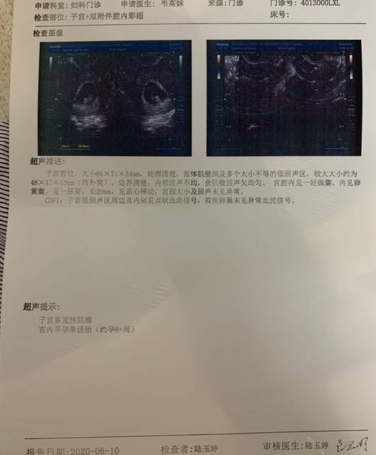 中南医院供卵做试管婴儿费用是多少
