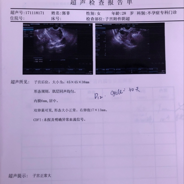 供卵试管卵泡18左右什么时候取