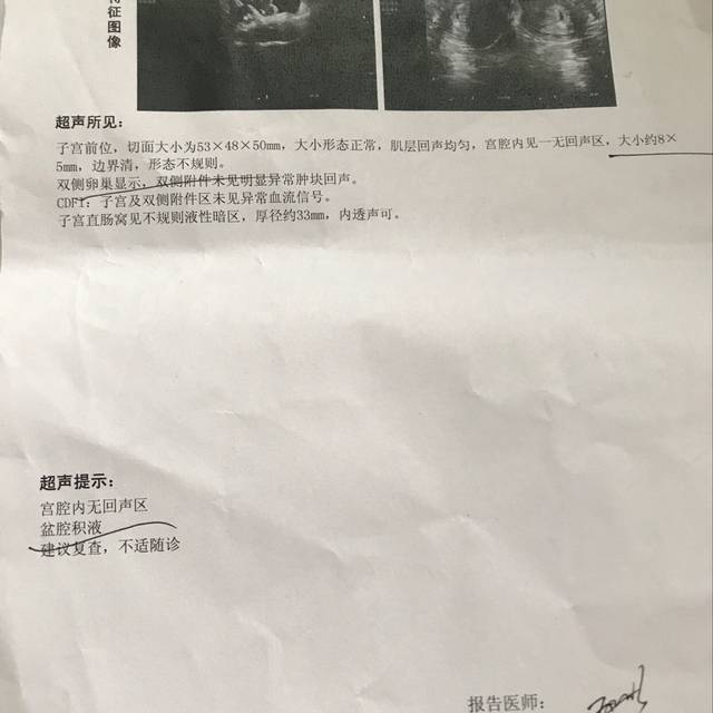 宫腔镜后多久可以赠卵试管促排