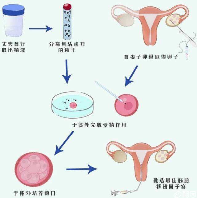 男人性功能不行可以做试管吗