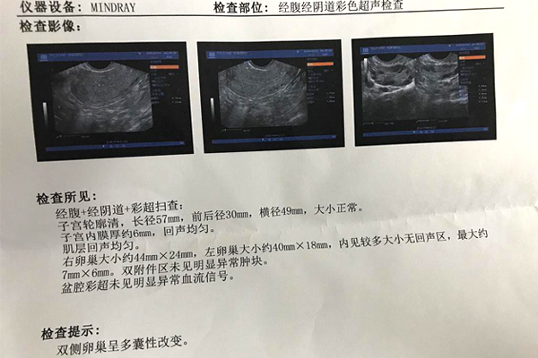 石家庄试管婴儿医院排名最好