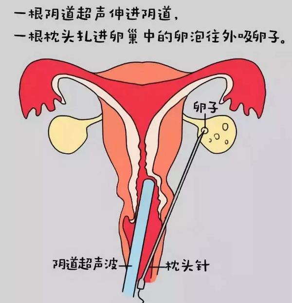 铁夹应夹在试管的