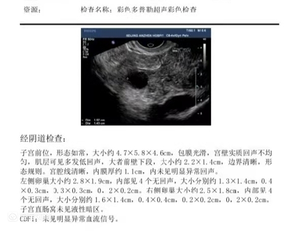 做试管最多做多少次成功