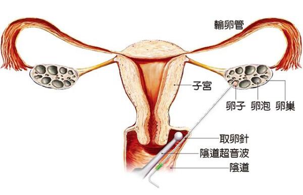 做试管婴儿吃什么鱼好