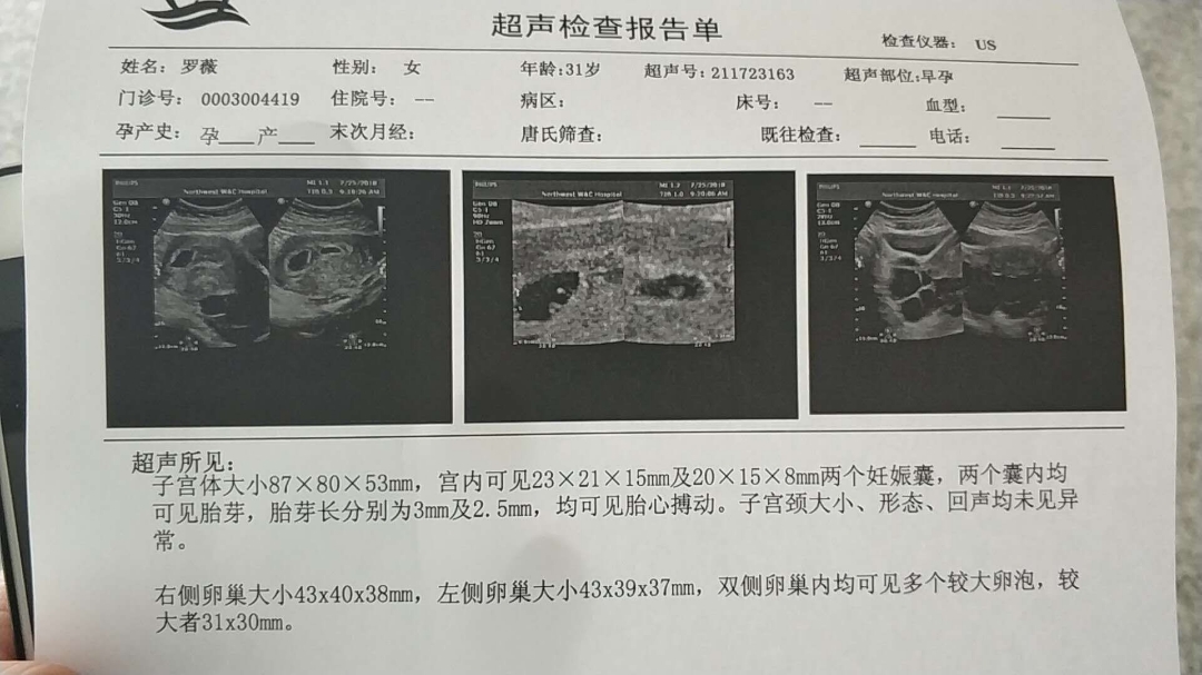 做试管为什么不成功的原因