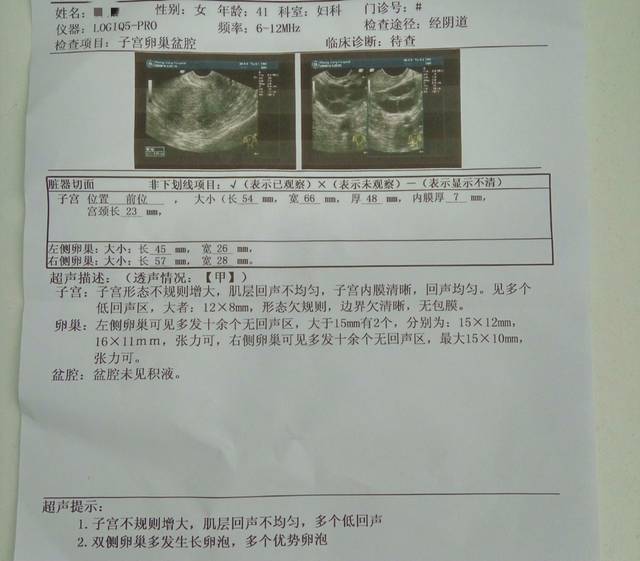 代生试管选性别费用移植成功经验