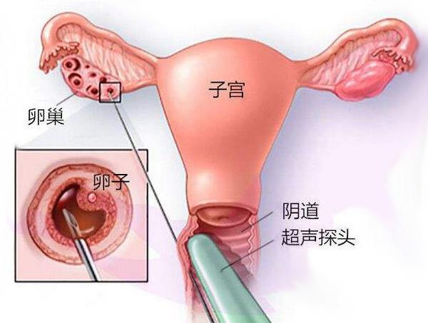 在河北省新华医院监测排卵做阴超和彩超哪个价格更贵？