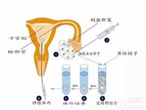 为什么精子库需要这么多精子