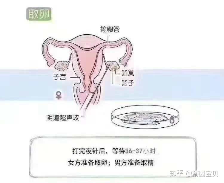 医院供卵代生子男性做精液检查应注意什么