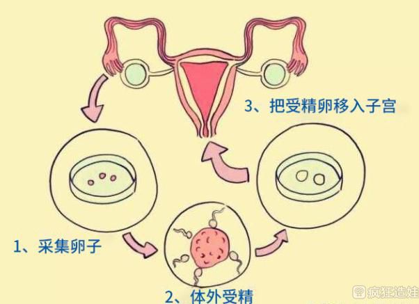 河北石家庄中医院医院借卵试管代怀有吗可以做两个吗（会不会有风险？）