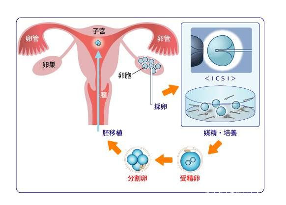 第三代试管代怀双胞胎可以做艾灸吗（看看老中医怎么说）