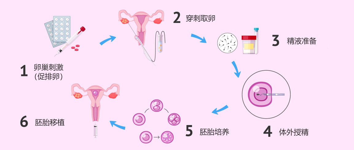 全国哪里试管代生宝宝+全国哪里可以做第三代国内借卵试管代怀流程