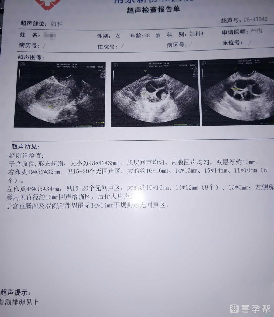 子宫肌瘤会影响怀孕吗（会影响三代试管私人医院吗？）