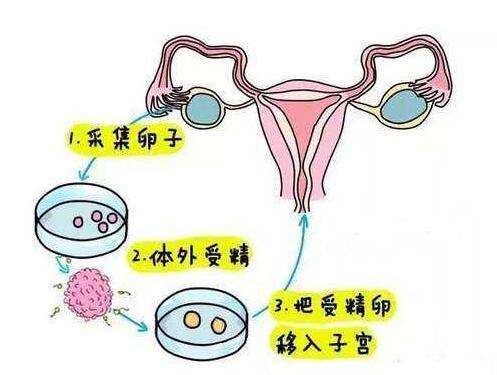 艾滋病去河北找人做代怀婴儿流程咋样的